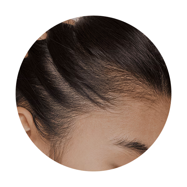 Dry Hair